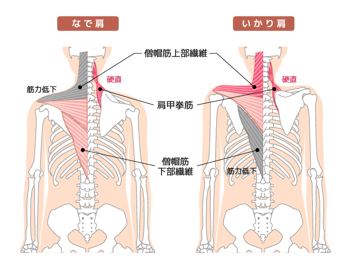 肩こり解消法 タイプ別おすすめストレッチ エクササイズをご紹介 東中野駅 徒歩1分 新宿から5分 ナーヴルーツ整体院 腰痛 肩こり 坐骨神経痛 自律神経失調症他 様々な慢性症状の根本原因へアプローチ